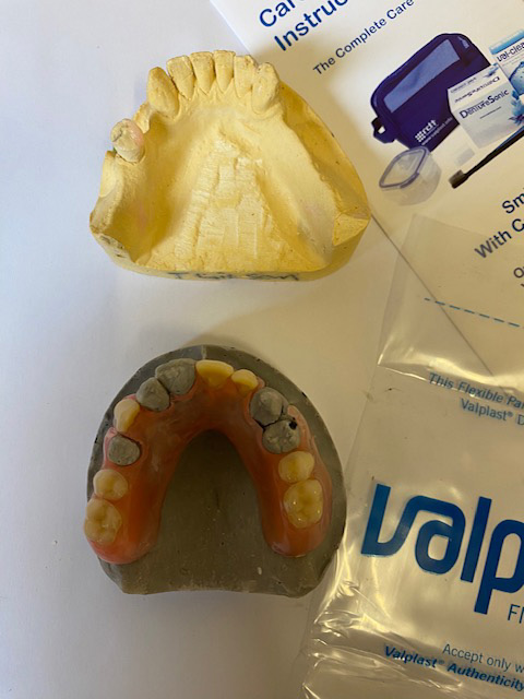 Impression and final denture