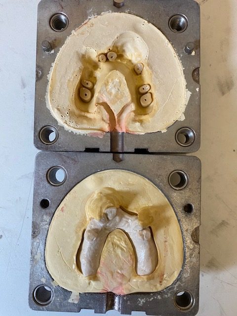 Valplast denture molds